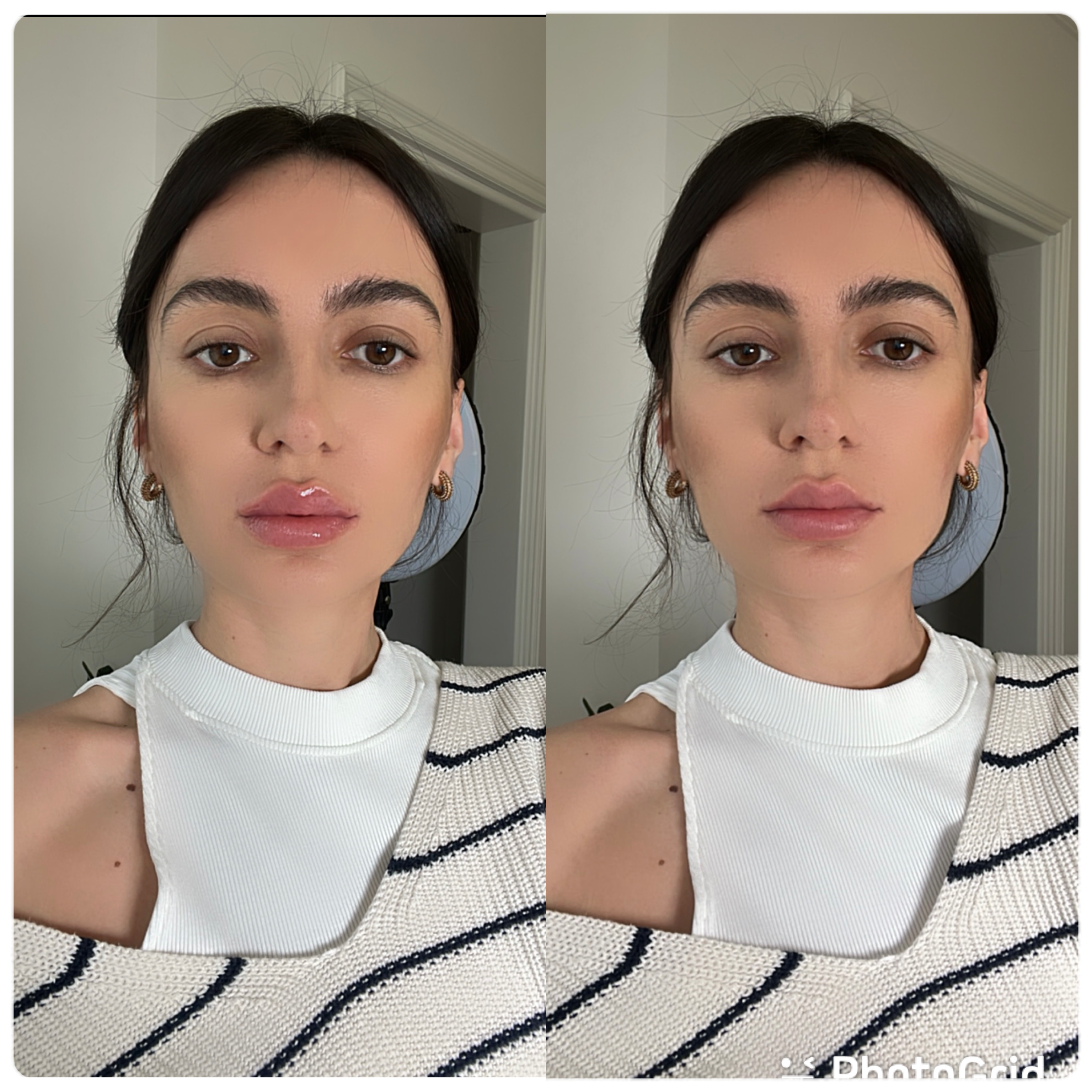 LIP PLUMPER