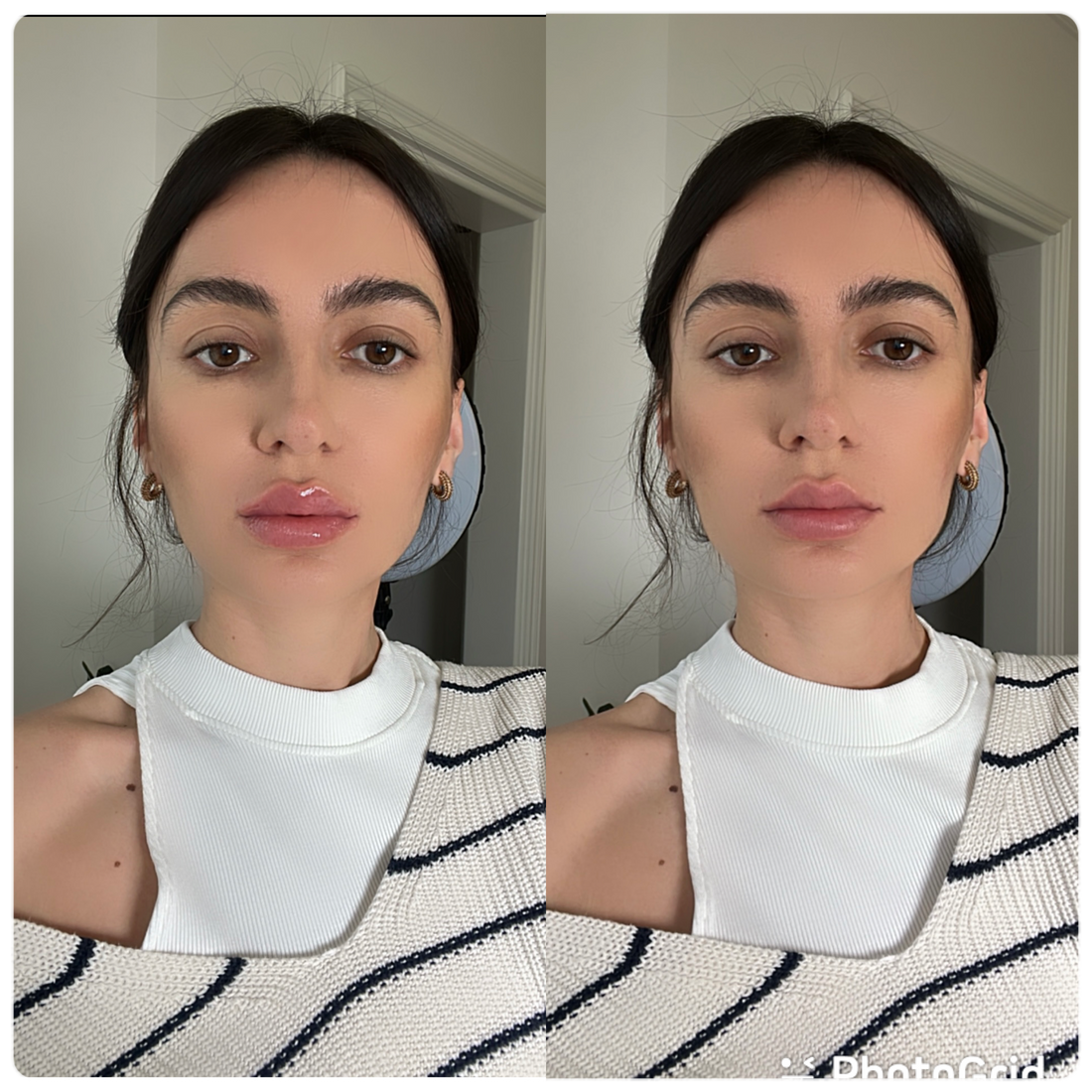 LIP PLUMPER